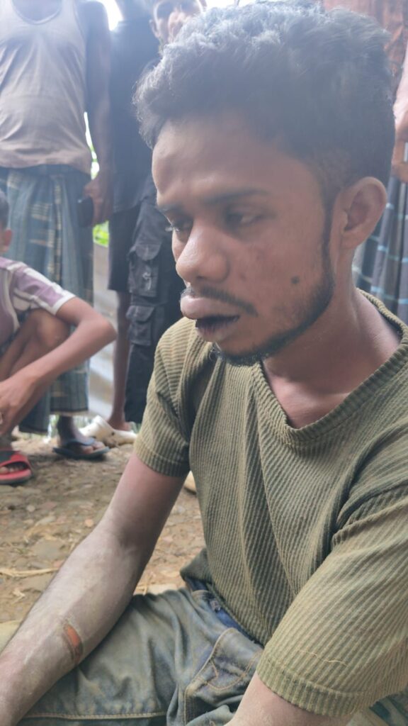 বক্রিহাওয়রে ডাকাতি, গৃহকর্তাকে দায়ের কোপ, পাকড়াও এক ডাকাত বক্রিহাওয়রে ডাকাতি, গৃহকর্তাকে দায়ের কোপ, পাকড়াও এক ডাকাত