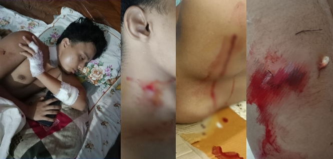 উধারবন্দে ভাইপোকে কাঁচি দিয়ে এলোপাতাড়ি কুপিয়ে হত্যা করার চেষ্টা, মামলা